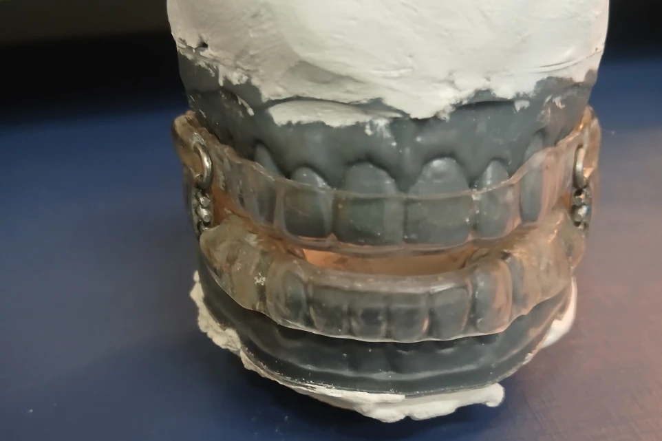 Dr Fabio Kruger Dentista Em Santa Maria Rs 20 (5)